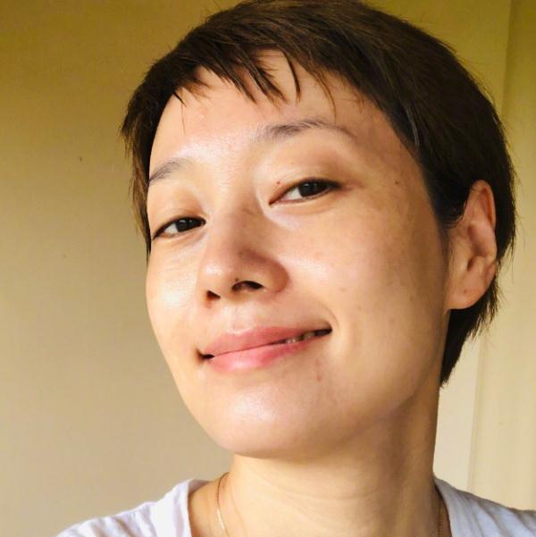 五官好看的脸型特别显老,五官再好看也扛不住秃发