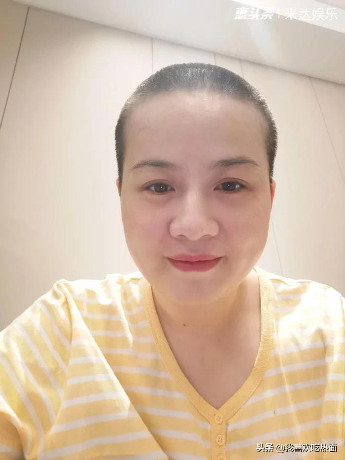 岳云鹏自曝成名后的困惑,岳云鹏哭诉前后照片