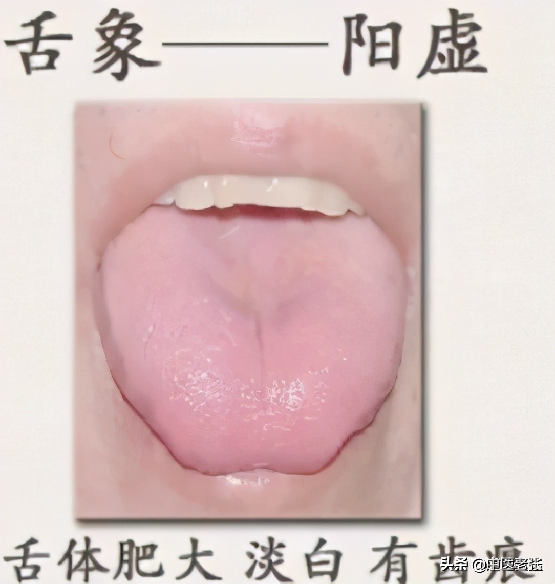 珍贵的舌诊图谱，看舌头知健康，人手一份！你也能快速识别疾病