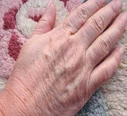 怎么让粗糙手变滋润小妙招,手部干燥怎么护理快速嫩白