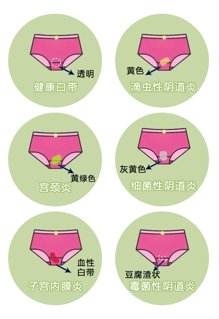 教你如何辨别妇科炎症「妇科小知识」