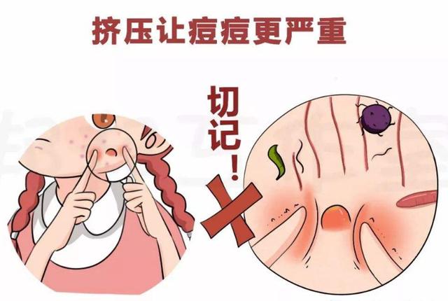 脸上痘痘很红怎么办,脸上长了一个很硬很痛的痘痘