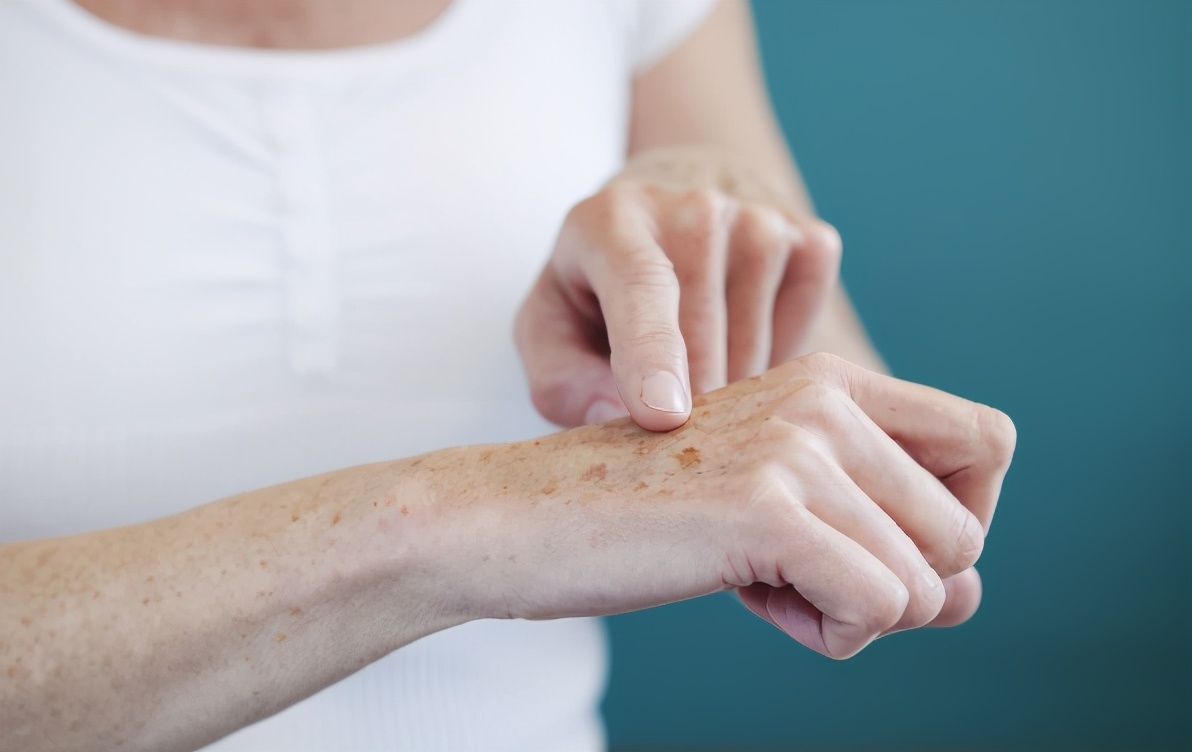 身上长老年斑吃什么调理,身上老年斑怎么可以去除