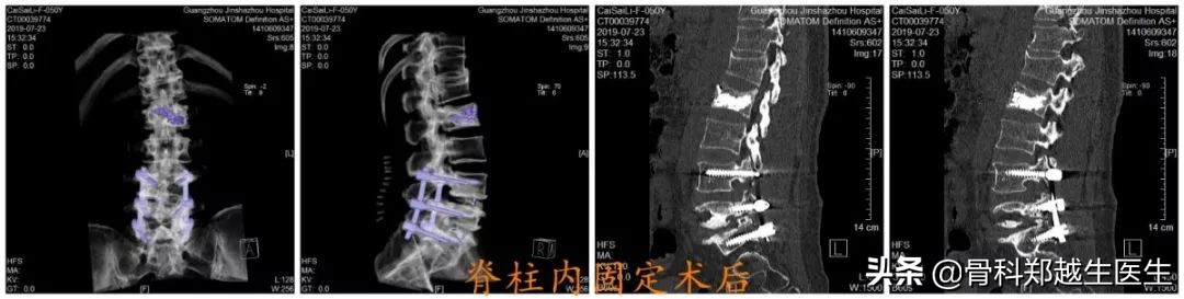 腰椎、颈椎疼痛，能不能推拿按摩治疗？骨科医生提出了这样的意见