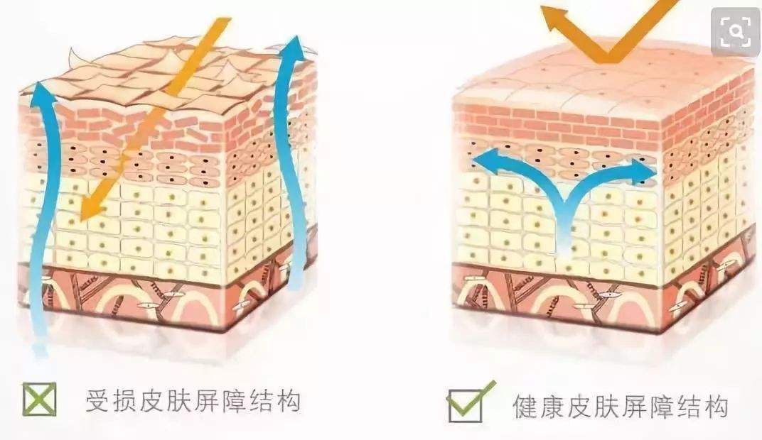 秋冬皮肤瘙痒怎么解决,换季皮肤痒是什么皮炎