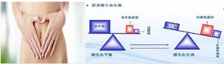 引起女性私密疾病原因有哪些？