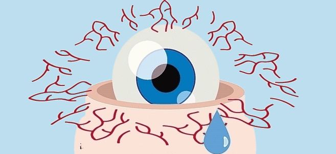 面肌痉挛右眼皮跳北京哪里治疗,眼皮一直抽搐跳动的原因面肌痉挛