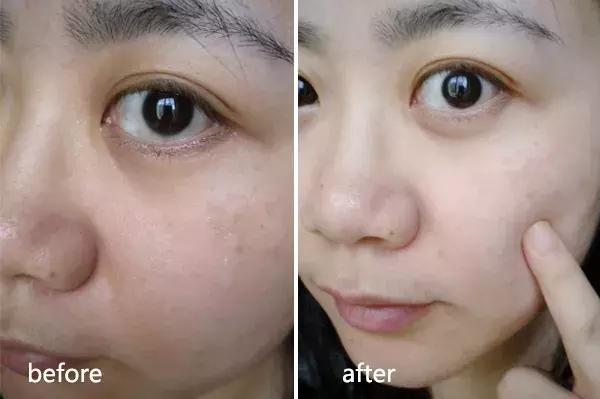 美白大创精华,大创美白精华