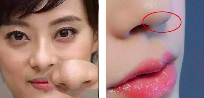 赵丽颖黑头,赵丽颖素颜照片真实对比