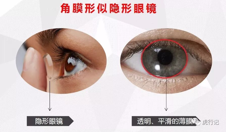 眼球外部有一层透明膜,眼球的外膜中膜内膜分别包括什么