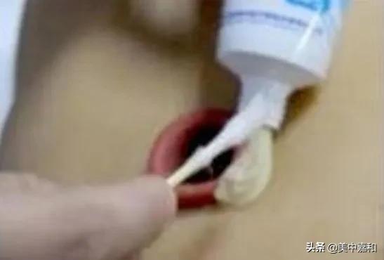 癌症妈妈的真相,癌症妈妈真实故事