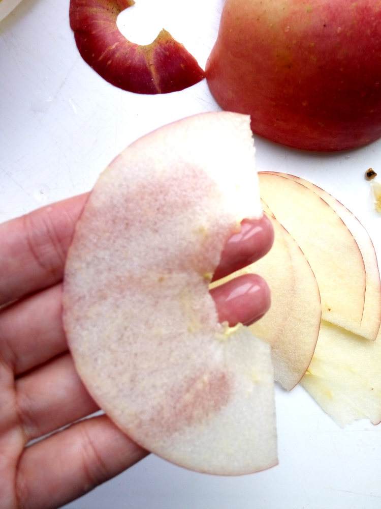 黑眼圈非常严重用什么方法去除,黑眼圈严重怎么办才能彻底去除