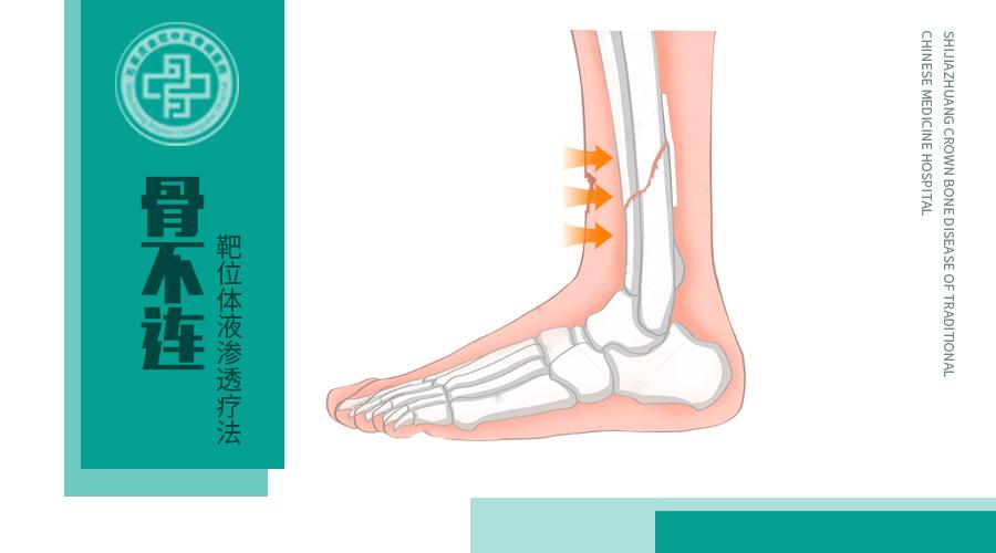 骨折后断骨怎么恢复,骨折后筋断了怎么锻炼