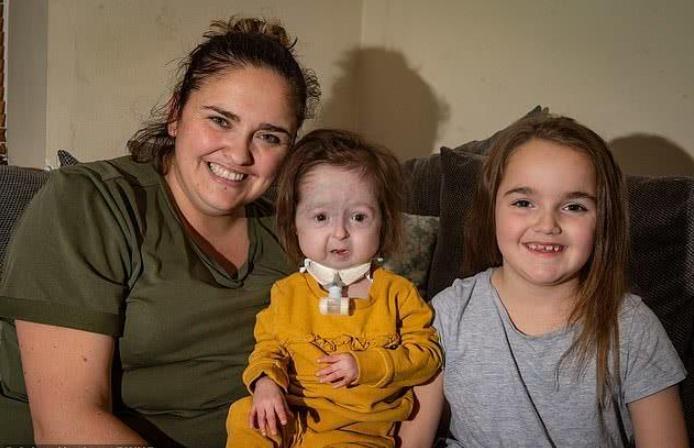 2岁小女孩得了罕见的病视频,2岁女童患罕见绝症