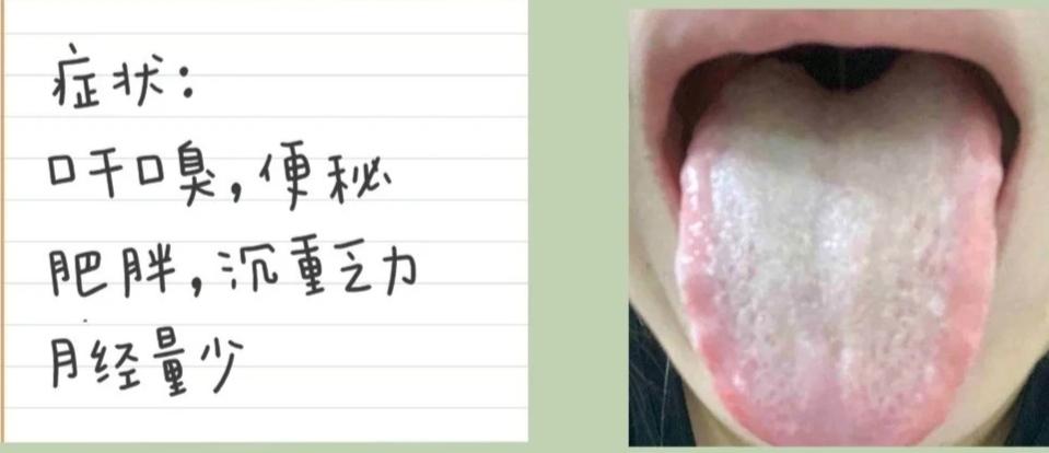 便秘大便干燥像羊便什么原因,便秘但是大便溏稀是怎么回事