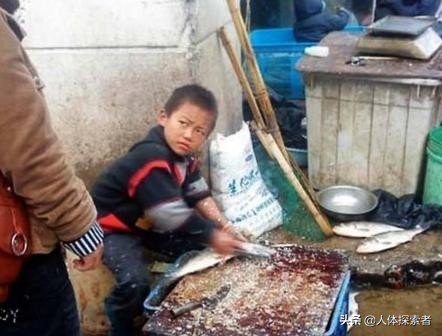 山东齐鲁医院百草枯中毒治好案例,齐鲁医院百草枯救活有多少案例