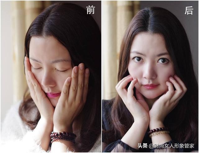 脸上的黑头让人讨厌，严重拉低你的颜值，如何有效祛黑头？