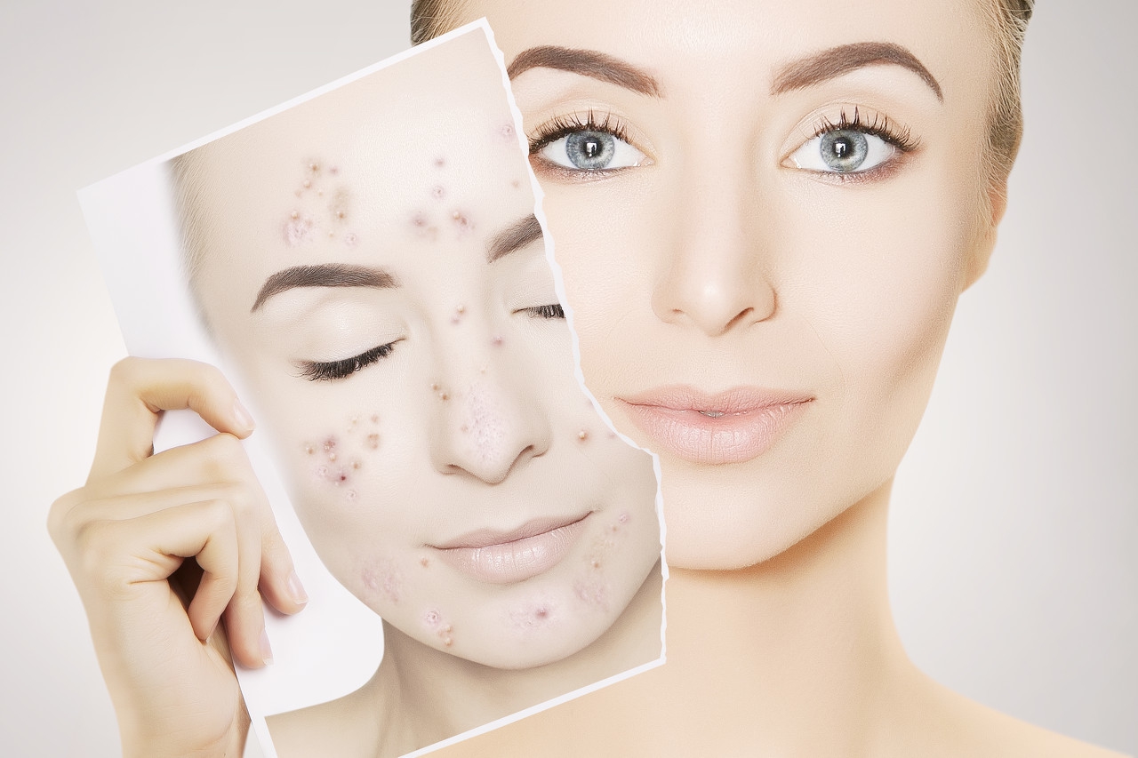 肤色黝黑且肤色不匀,肤色不匀怎么改善靠谱方法