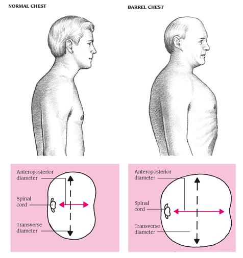 身体太厚是胖吗,身体很胖可是还是很虚是什么原因