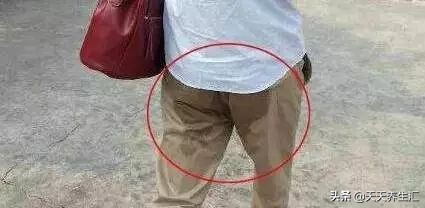 男性根部潮湿瘙痒用什么药,男性腿两侧根部瘙痒用什么膏药