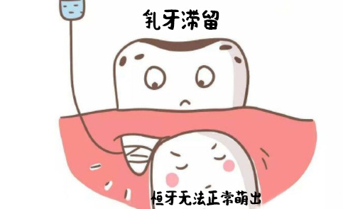 牙齿矫正前要把牙刷干净吗,戴牙套前的步骤和牙齿矫正的过程