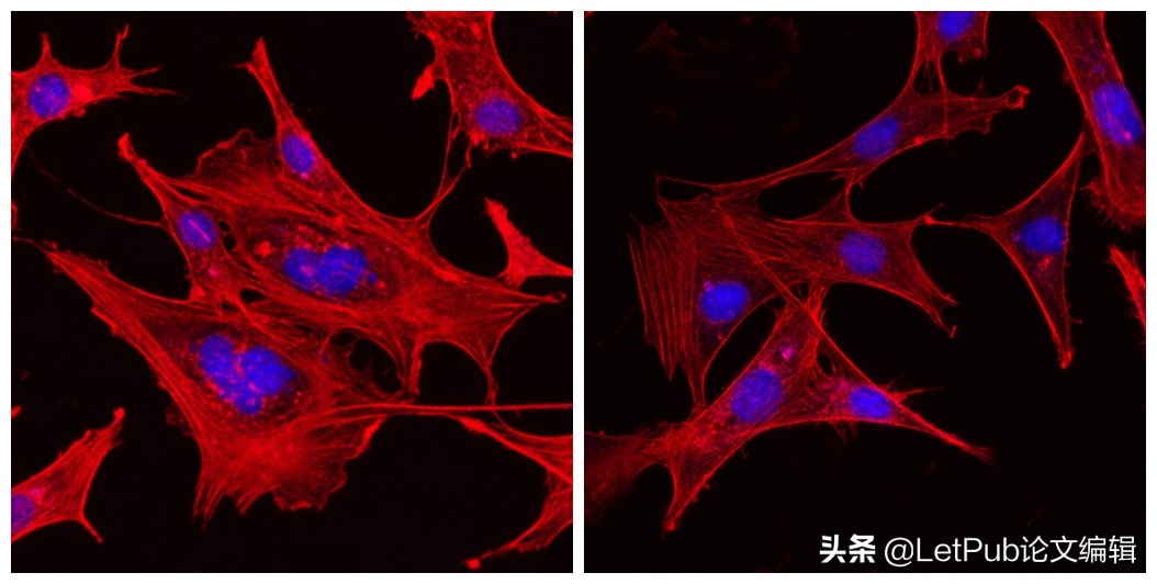 小说封面设计入门教程,怎么让自己的文章变成动画