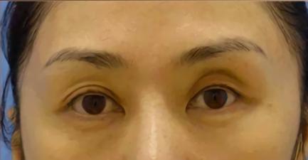 眉弓多高最合适,眉弓怎么判断高低