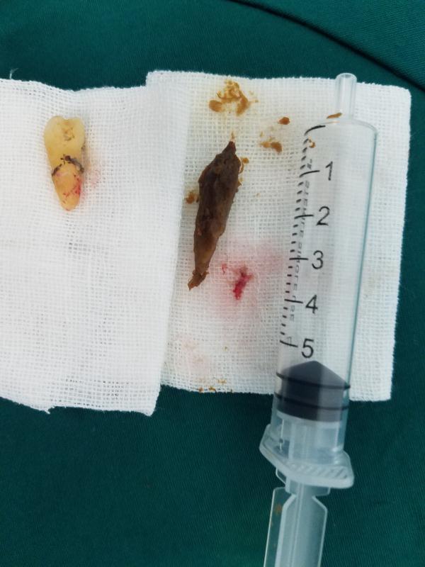 沈阳四院治耳鼻喉好吗,沈阳四院治耳鼻喉吗