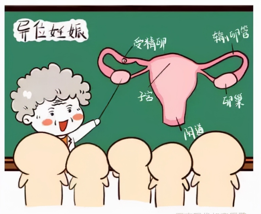 宫外孕不小心吃了流产药,宫外孕吃流产药后果