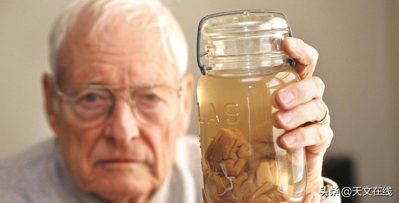爱因斯坦的大脑解剖全过程,爱因斯坦的大脑和正常人什么区别
