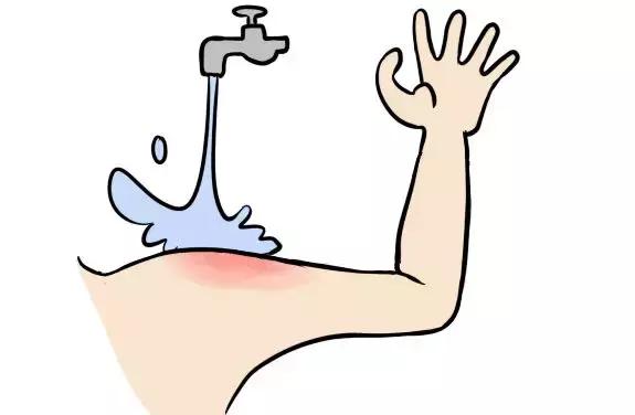 开水烫伤和烧伤哪个严重,为啥水蒸气烫伤比开水烫伤更严重