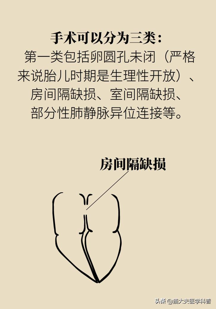 产检查出胎儿有问题,胎儿心脏有问题产检能发现吗