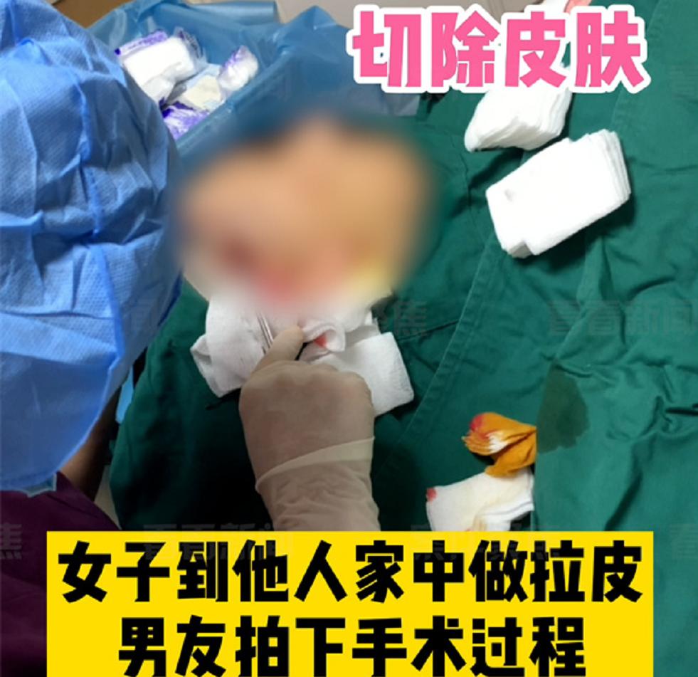 女子花1万块让朋友在家做拉皮手术，被医生诊断为面瘫，朋友曾非法行医被逮捕