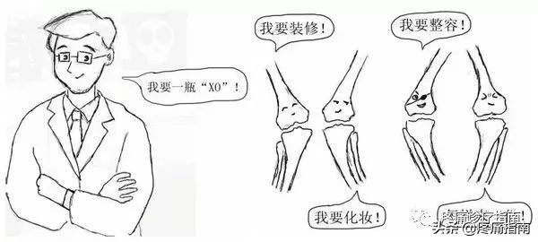 骨性关节炎诊疗方案及流程,骨性关节炎的护理诊断