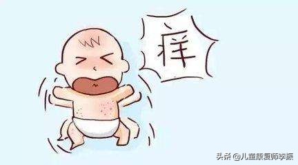 宝宝湿疹饮食禁忌食谱,宝宝起湿疹妈妈饮食需要注意什么