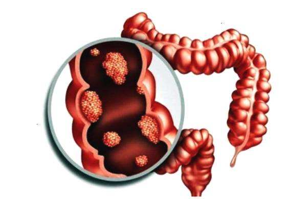 禁食三天只喝水身体的变化,多久不喝水对身体有危害