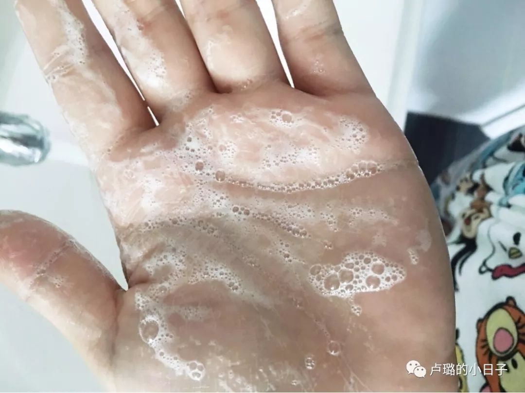 可以拯救发际线的洗发水推荐,拯救干枯毛躁和去屑的平价洗发水