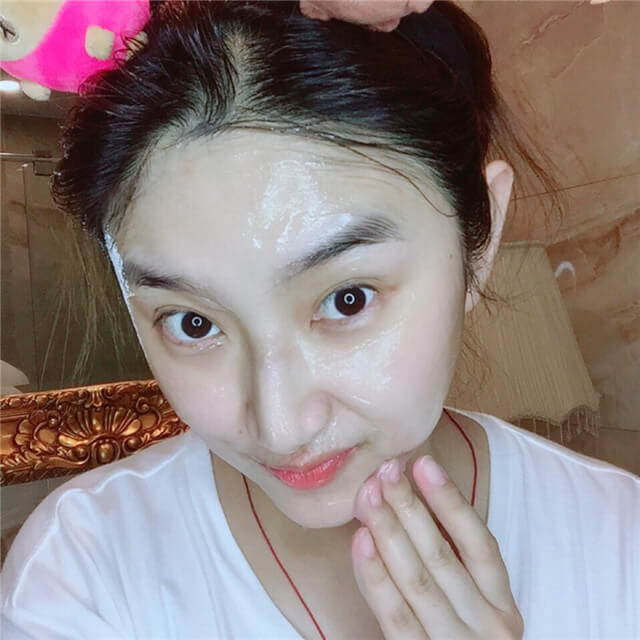 脸上的皱纹怎么解决小妙招,脸上长皱纹教你一招轻松除皱纹