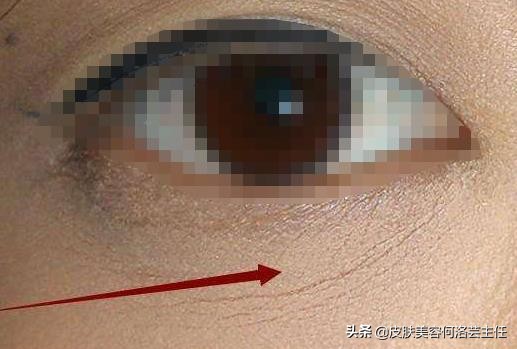 脸上出现皱纹，我老了？5个皱纹产生的原因，别再视而不见