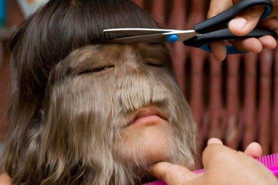 西班牙多名儿童服用来自印度的问题药物，患狼人多毛症似猴孩