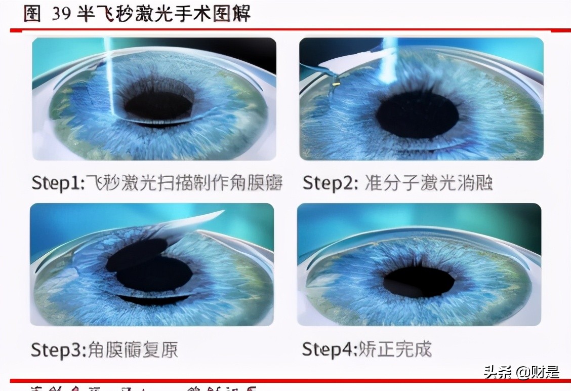 爱博医疗眼科器械上市,眼科行业研究报告
