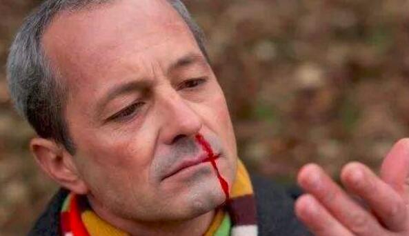 上火会引起鼻腔血块吗,鼻出血上火吃什么可以去火