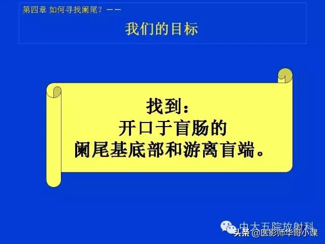 阑尾炎课件,阑尾炎的超声课件