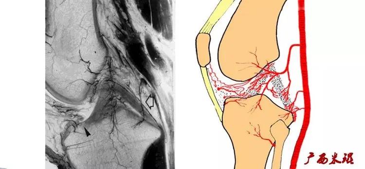 前交叉韧带扭伤最快自愈方法,前交叉韧带损伤膝关节会疼吗