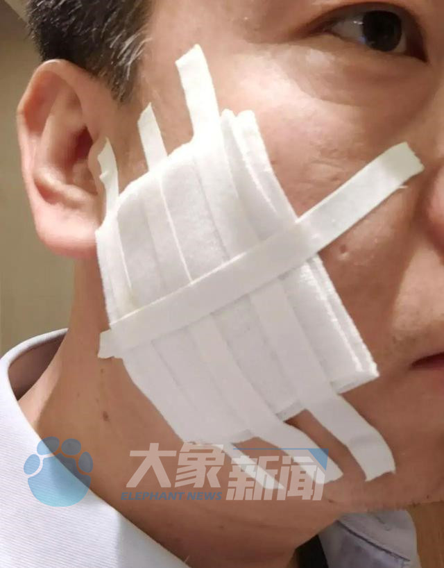 陕西西安高管聚会烟头烫伤员工,用烟头烫员工脸的高管已被免职