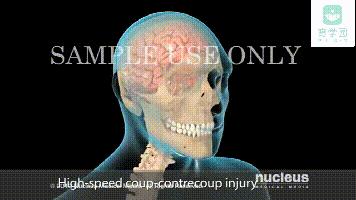 宝宝摔头起包后留下一个硬坨,宝宝头上摔了个包有没有潜伏期