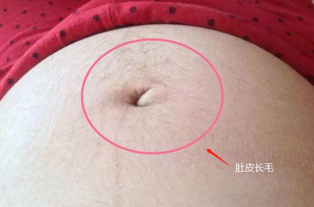 准妈妈孕期肚皮上为什么会长毛？老人说怀的男宝，真的是这样吗？