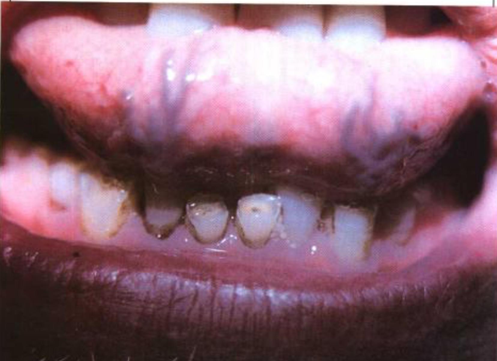 如何从舌苔判断健康,怎样通过舌苔颜色判断身体状况