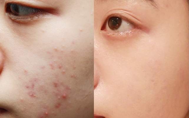 芙清敷尔佳创福康,芙清的面膜好用吗