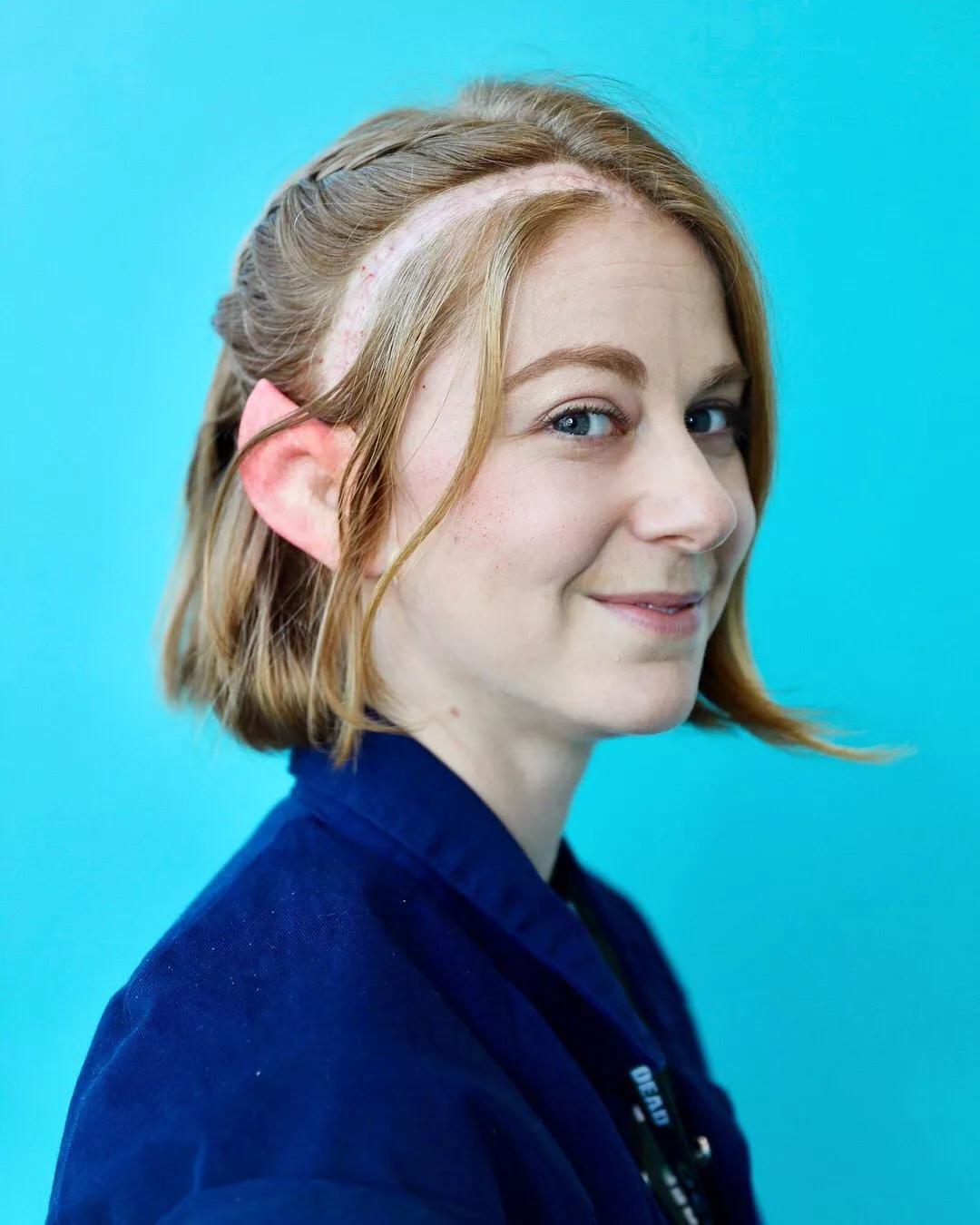 癌症女孩奇迹痊愈,90后女子研究出癌症不用动刀